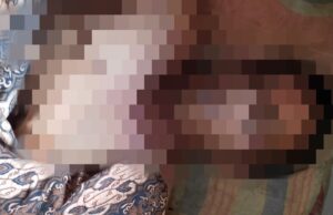 Warga Bogor Tersambar Petir, Keluarga Tolak Jasad Korban Diotopsi