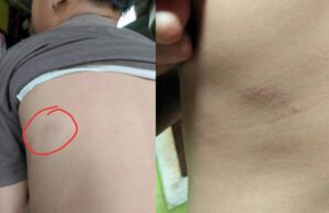 Kekerasan Terhadap Anak Didik Kembali Terjadi di Bogor, Siswa SDN Sangkali 01 Trauma Akibat di Aniaya Oknum Guru