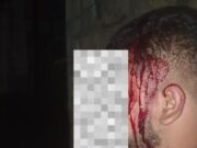 Pengunjung THM Cabin Bogor Jadi Korban Pengeroyokan, Oknum Keamanan Diduga Pelaku