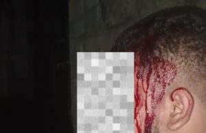 Pengunjung THM Cabin Bogor Jadi Korban Pengeroyokan, Oknum Keamanan Diduga Pelaku